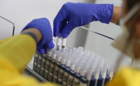 Pandemia favorizoi bizneset ne shendetesi: 139 subjekte te reja u hapen ne 2020
